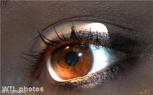 Orthokeratology contact lenses can help slow the onset of myopia