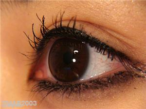 Eye exercises and ortho k 